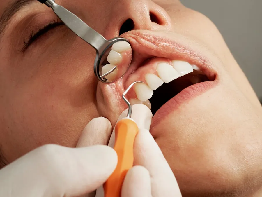 Ilustrasi mimpi dokter gigi — dental exam with mirror and tool