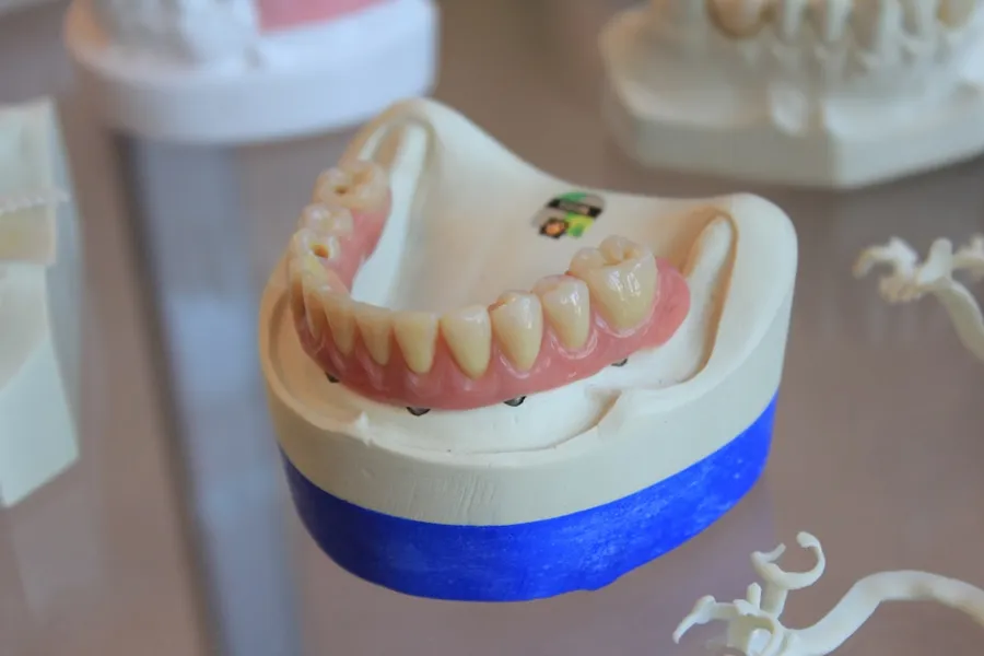 Ilustrasi mimpi gigi geraham copot — dentures on white scale rack