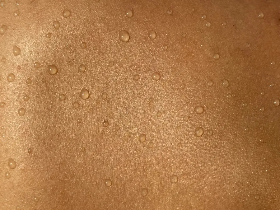Ilustrasi mimpi orang sakit gudig — A man's back with water drops on it