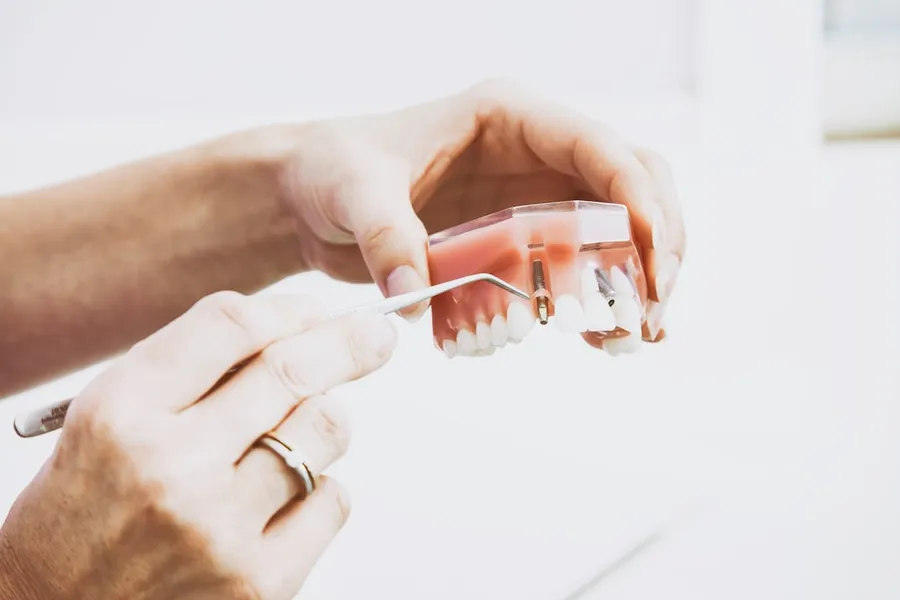 Ilustrasi mimpi pasang gigi palsu — person wearing silver-colored ring while holding denture