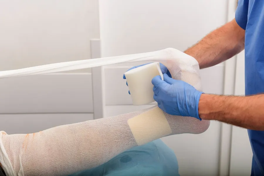 Ilustrasi mimpi patah tulang — man putting medical bandage on left foot of person